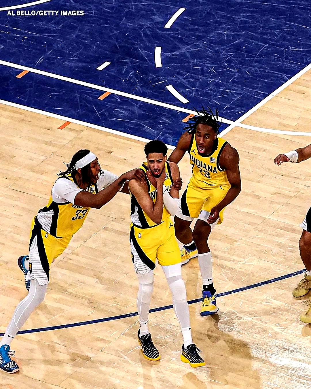 人击败步行者，取得本赛季首场胜利